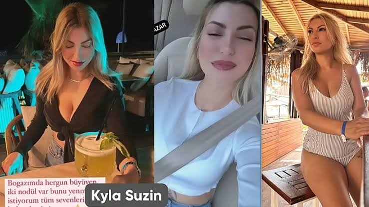 Kyla Suzin